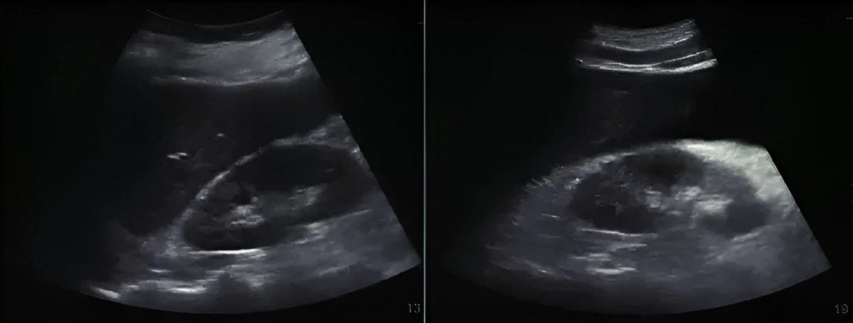 ultrazvuk-abdomena-1200x455.jpg